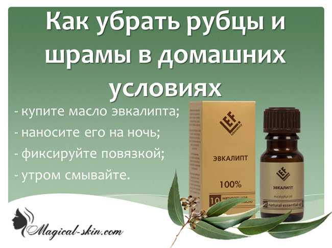 Как убрать рубцы и шрамы: подробно о способах удаления