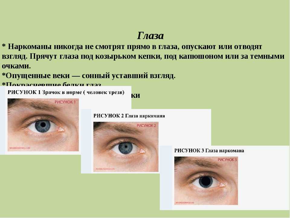 Расширенные зрачки — симптомы и причины расширенных зрачков, мнение экспертов - proinfekcii.ru