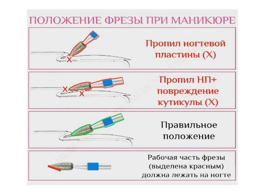 Как бороться с быстрым ростом кутикулы на ногтях: советы и рекомендации