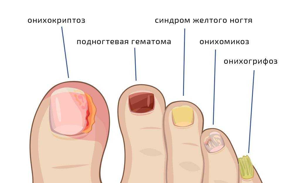 Анатомия ногтя для мастера маникюра