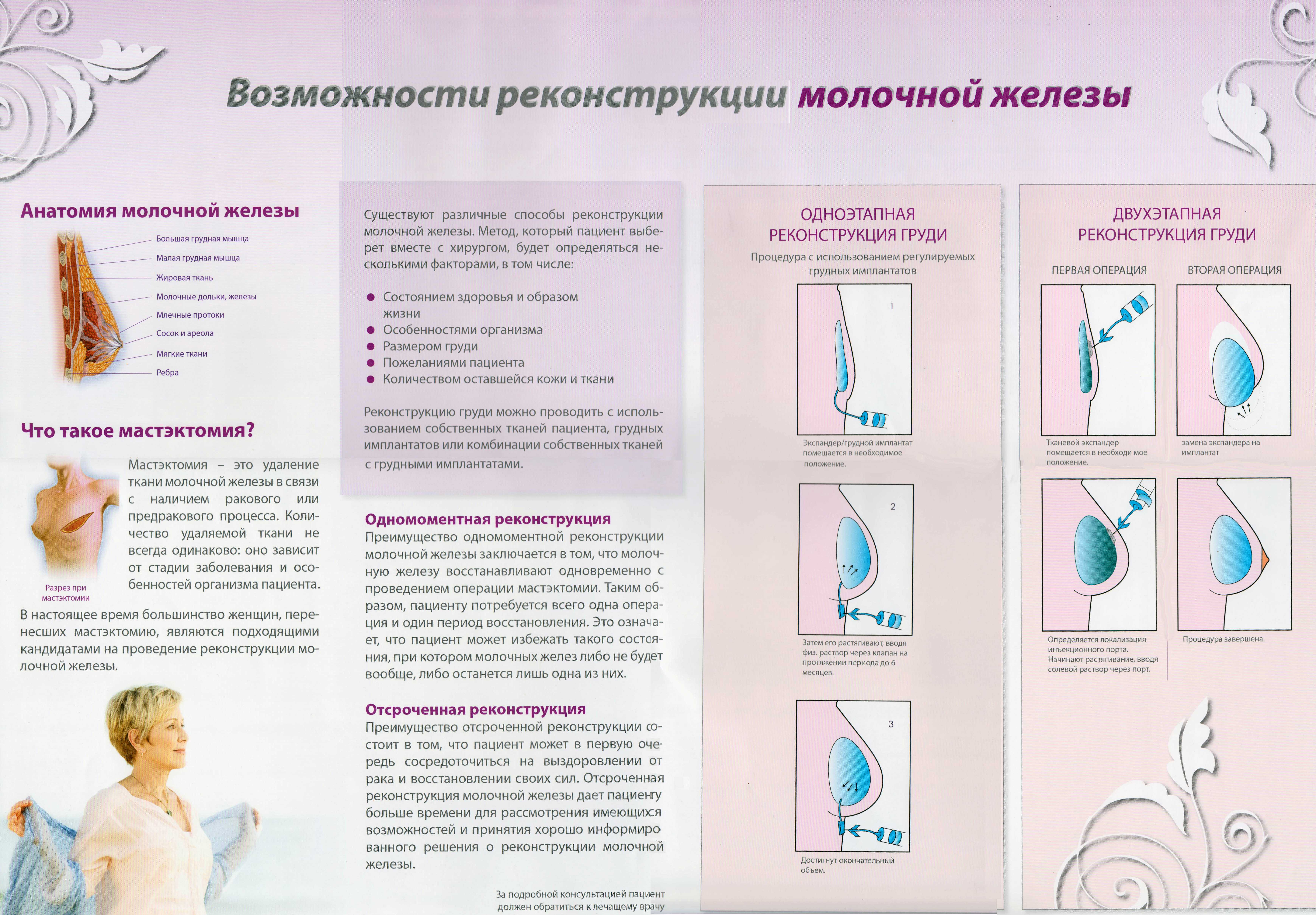 Рак груди: жить настоящим - vtomske.ru