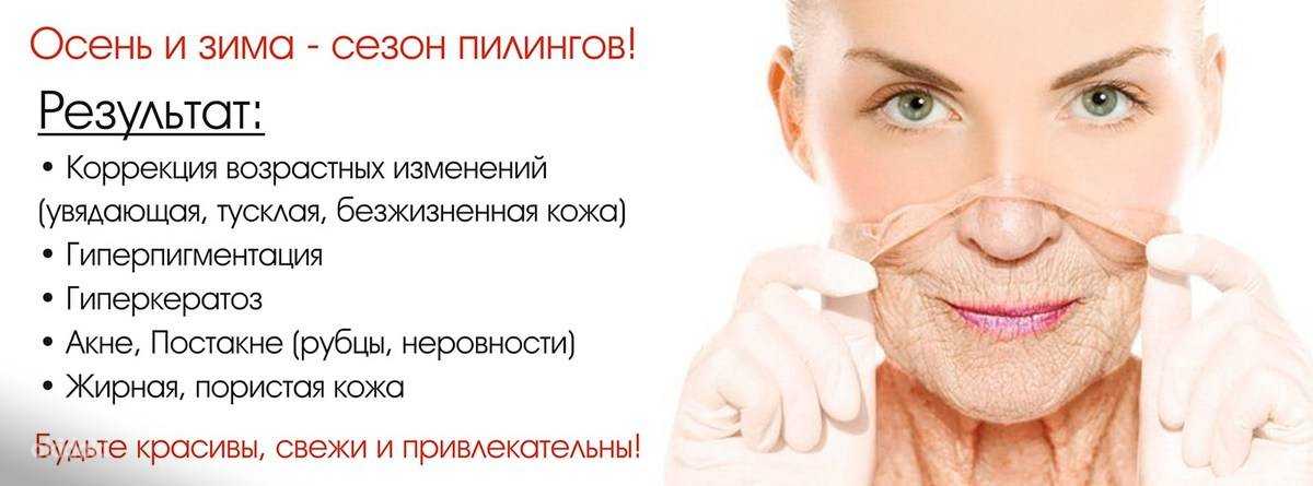 Пилинг с кислотами - применение 14-ти кислот, эффективность и показания— секреты красоток