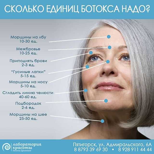 Морщины-марионетки: как избавиться от складок скорби?