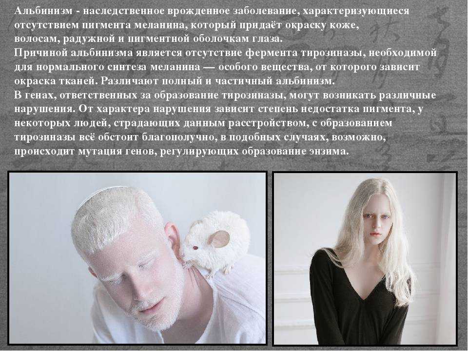 Альбинизм | биопедия вики | fandom