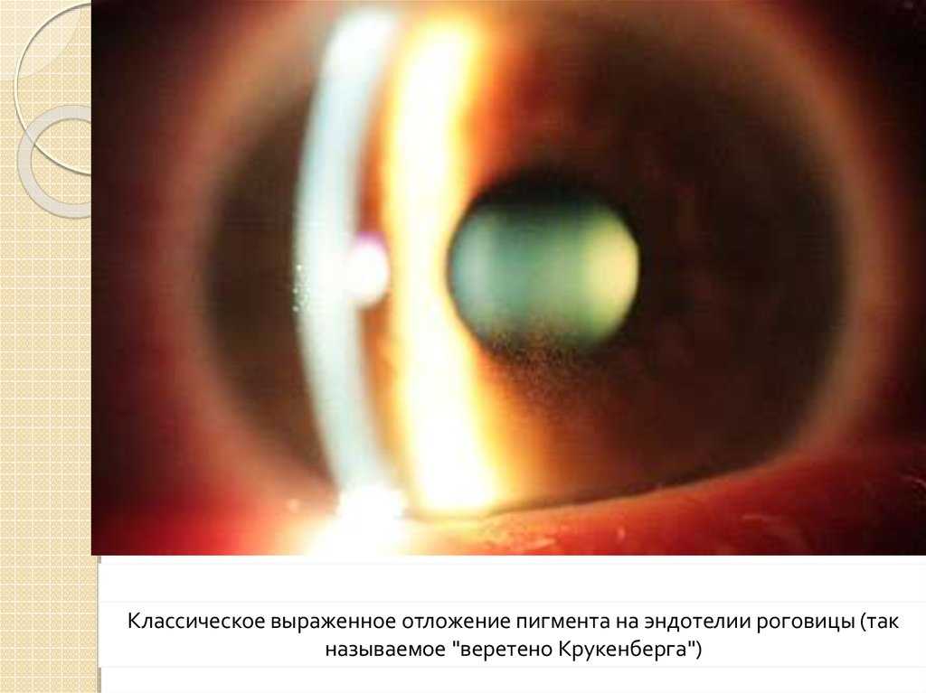 Может ли меняться цвет глаз от настроения?