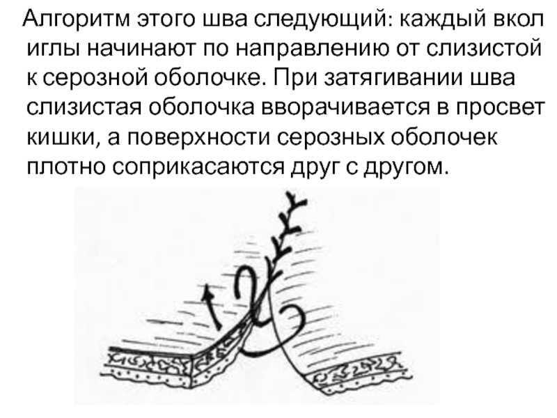 Расхождение швов: что это такое, почему это происходит и как с этим бороться