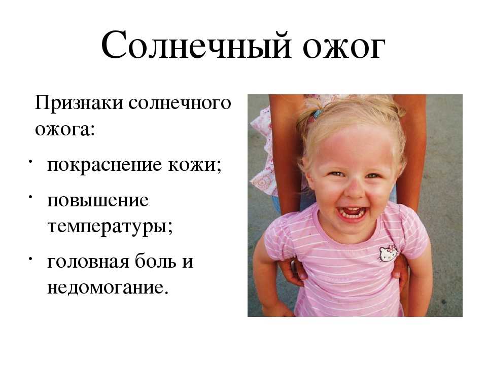 Можно ли загореть с солнцезащитным кремом с spf 30 и 50: ликбез от косметолога