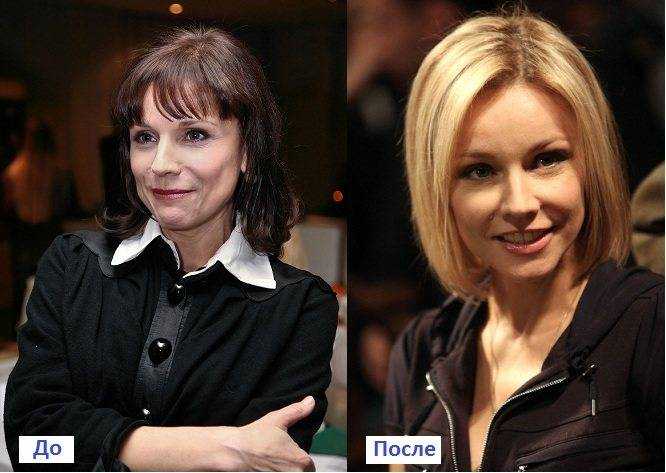 Марина зудина до и после пластической операции