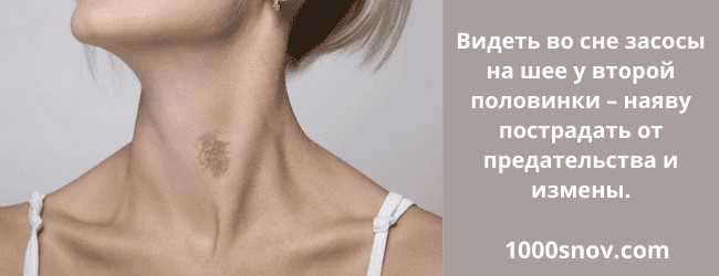 Как быстро убрать засос: лучшие способы устранения гематомы