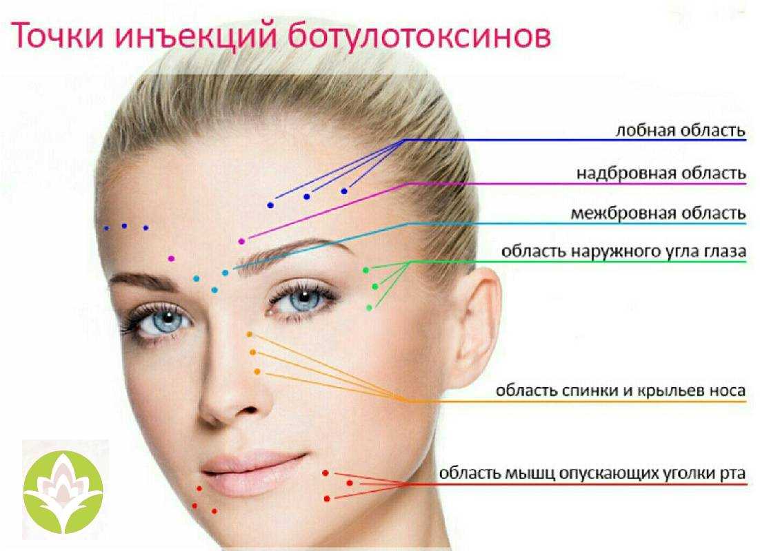 Мезоботокс: описание процедуры, эффект, показания