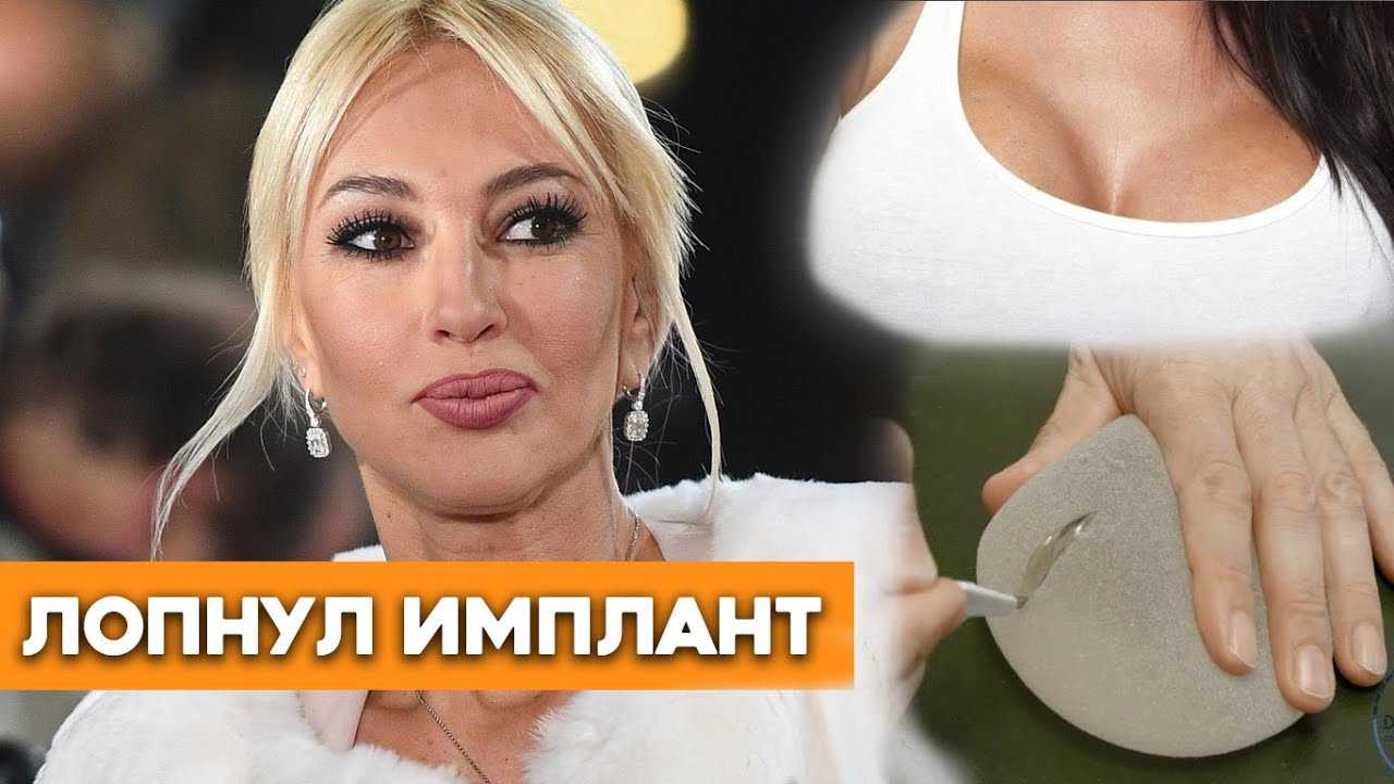 Звезды делавшие пластические операции: самые неудачные, фото