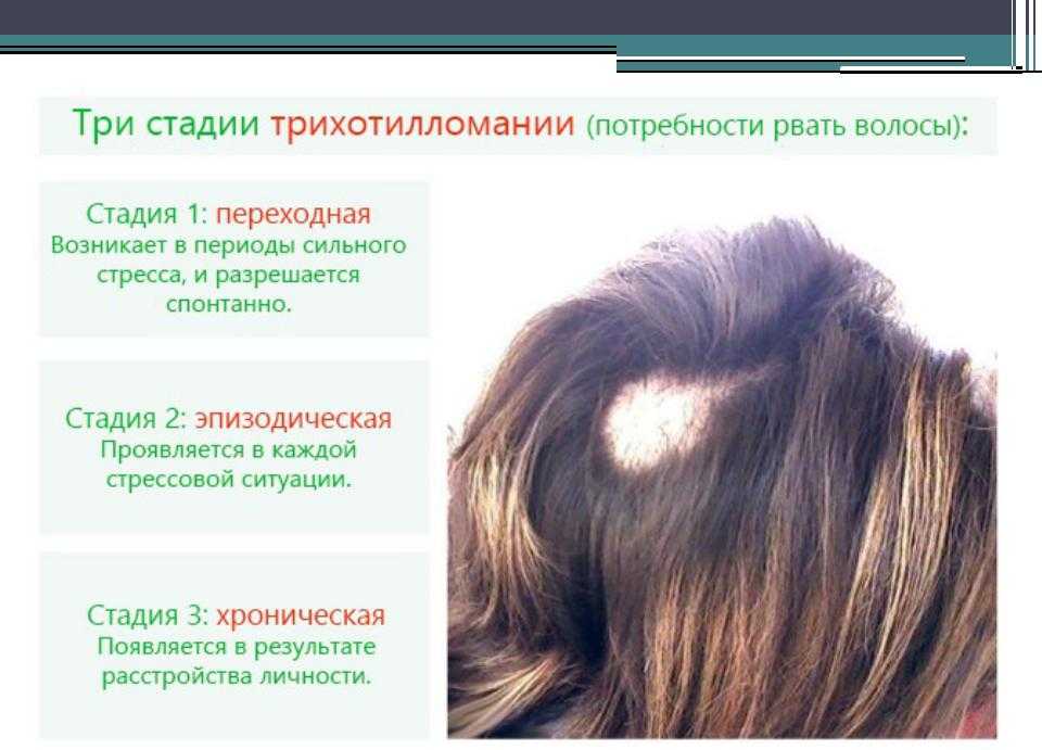 Как жить с алопецией: личная история | flacon