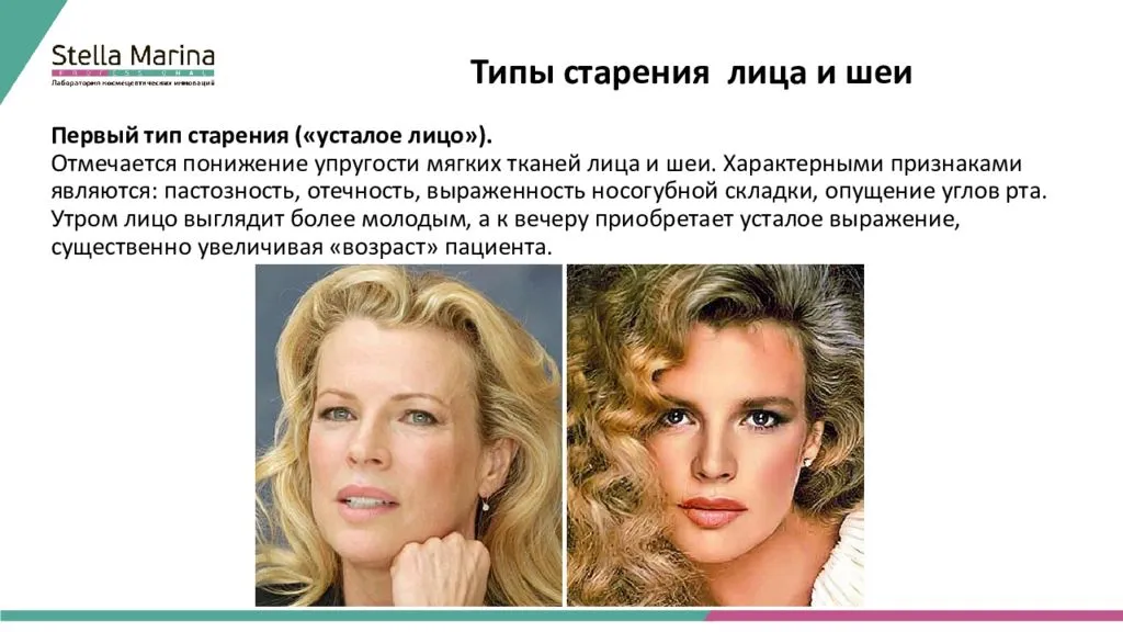 Омоложение лица после 50ти: какие косметологические процедуры выбрать?