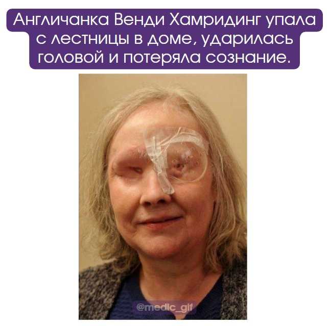 Синдром беременности у мужчин (кувад)