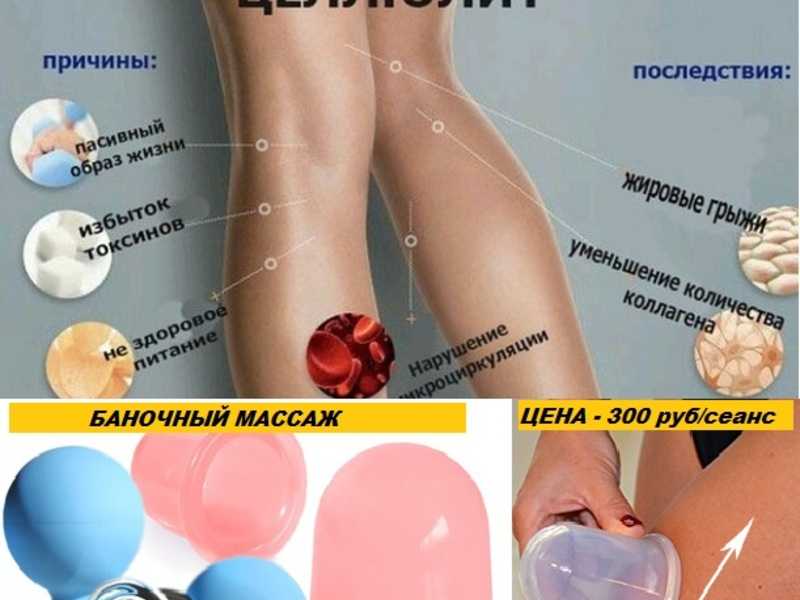 Техника антицеллюлитного баночного массажа: массажные банки «чудо-банка» — «как делать массаж банкой против целлюлита. фото-инструкция, техника, результат.» —  вместе — сайт общественного движения