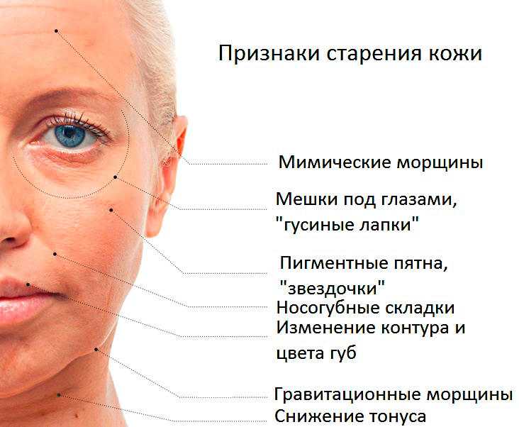 Типы старения лица, способы борьбы с увяданием кожи
