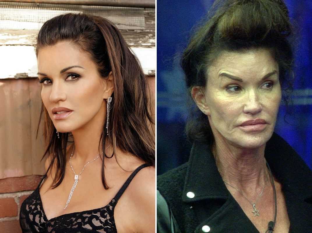 Jennifer grey plastic surgery: before and after images - the teal mango