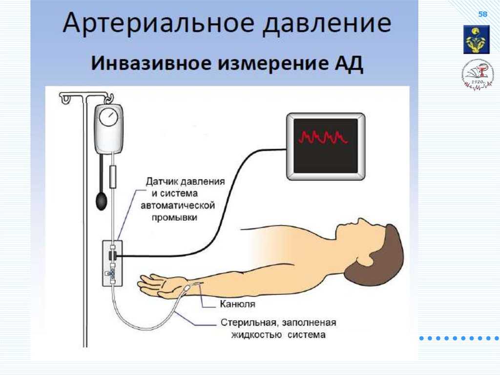 Взаимоисключающие параграфы — рациовики