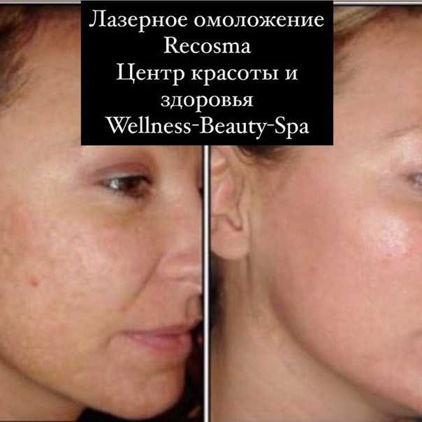 Массаж гуаша для лица — техника проведения самостоятельно