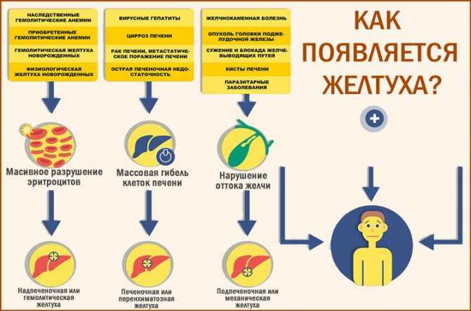 Желтые белки или склеры глаз: причины, лечение и возможные последствия