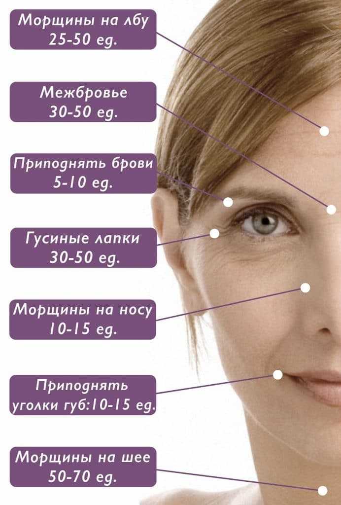 Морщины и их виды. причины раннего появления морщин. как образуются, и как от них избавиться?