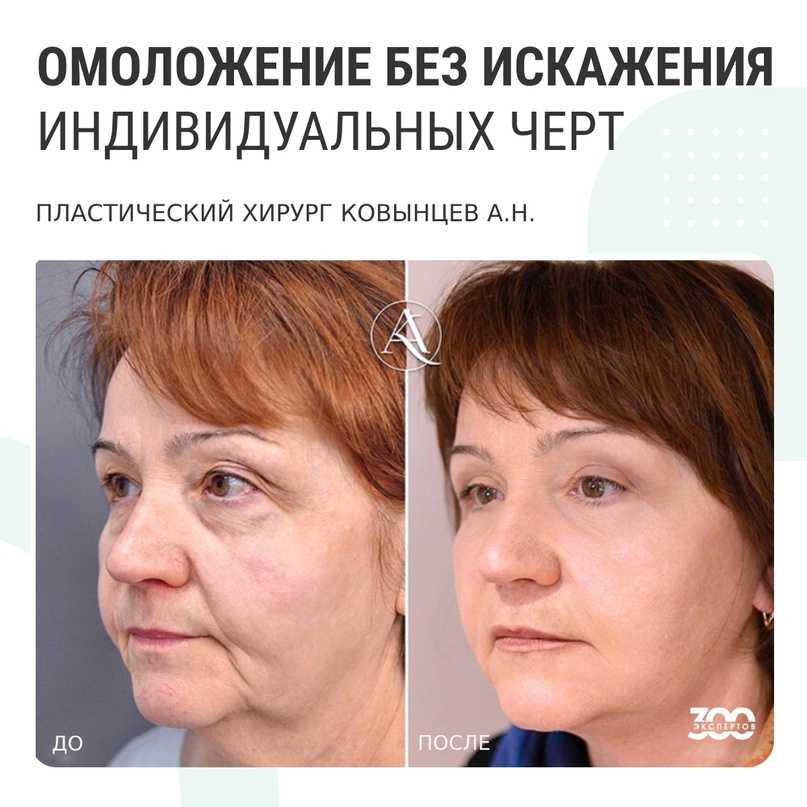 Игорь белый и его авторский метод 3s-лифтинг (2021) | spabamboo.ru