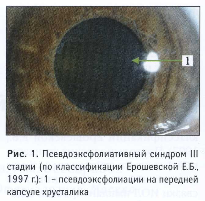 6 вещей, которые могут изменить цвет ваших глаз