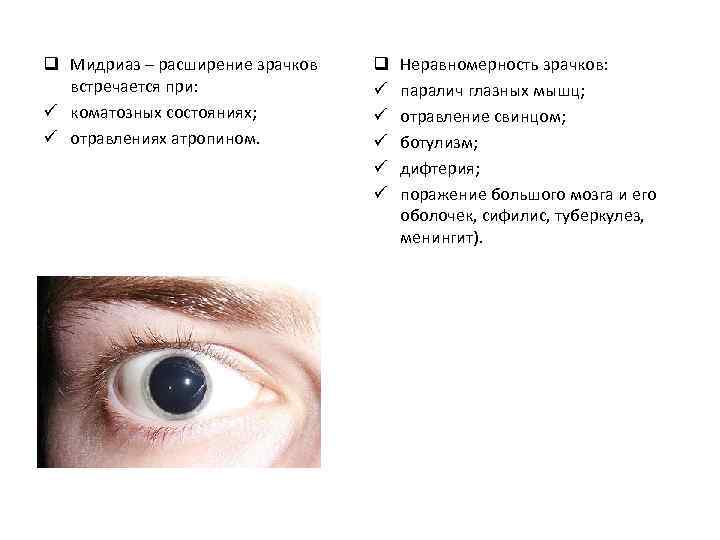 Почему увеличивается зрачок глаза у мужчин - жесты и сигналы
