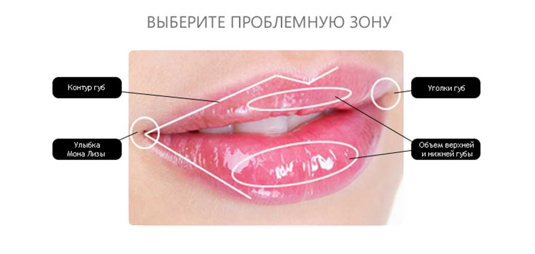 Безынъекционное увеличение губ
