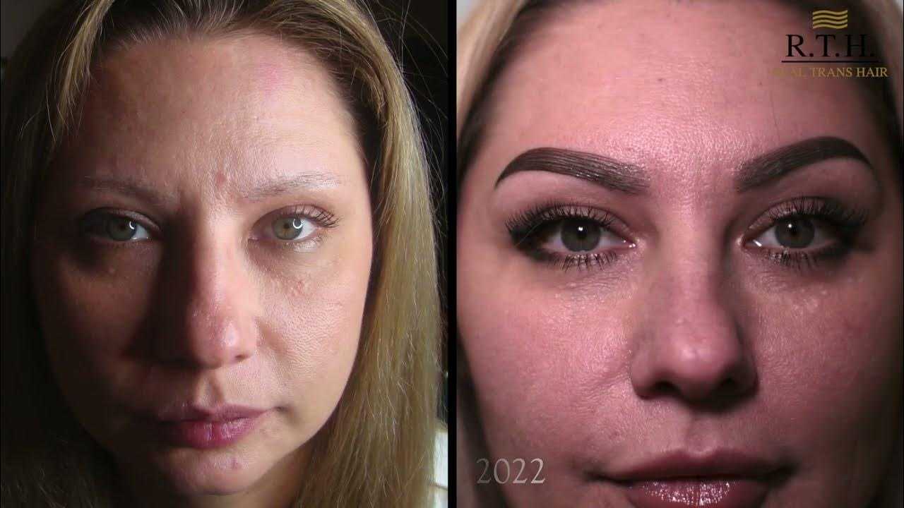 Создан инновационный метод замены поврежденных тканей