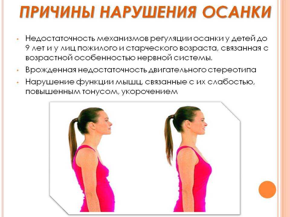 Как сделать идеальную осанку - упражнения за 21 день.