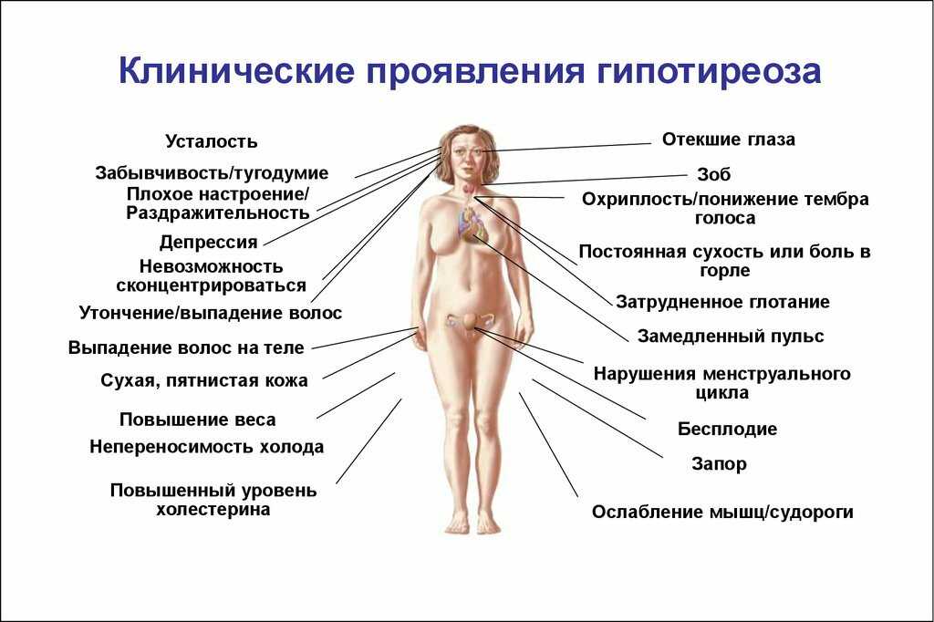 Как избавиться от синдрома отложенной жизни?