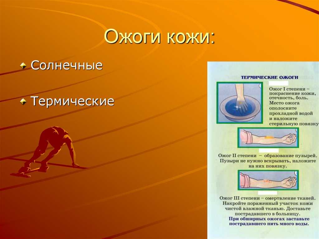 Осторожно, весеннее солнце и ультрафиолет | sovetyli