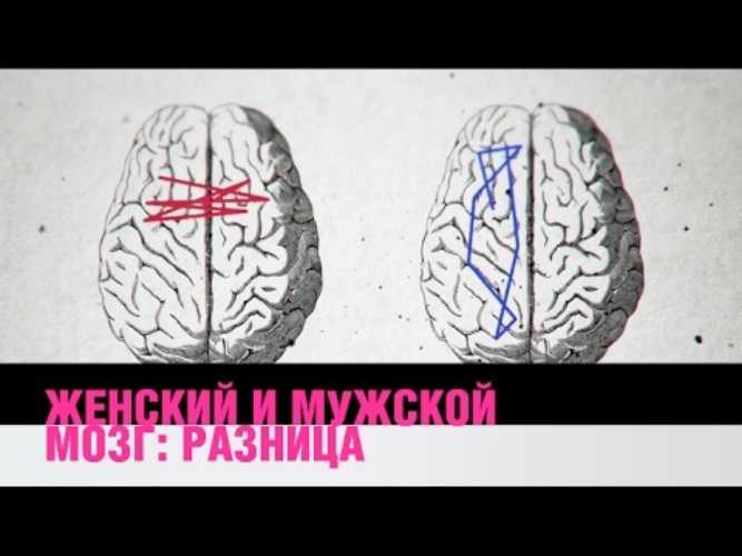 Нейросексизм