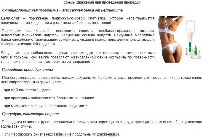 Баночный массаж спины в домашних условиях: методы, видеоуроки