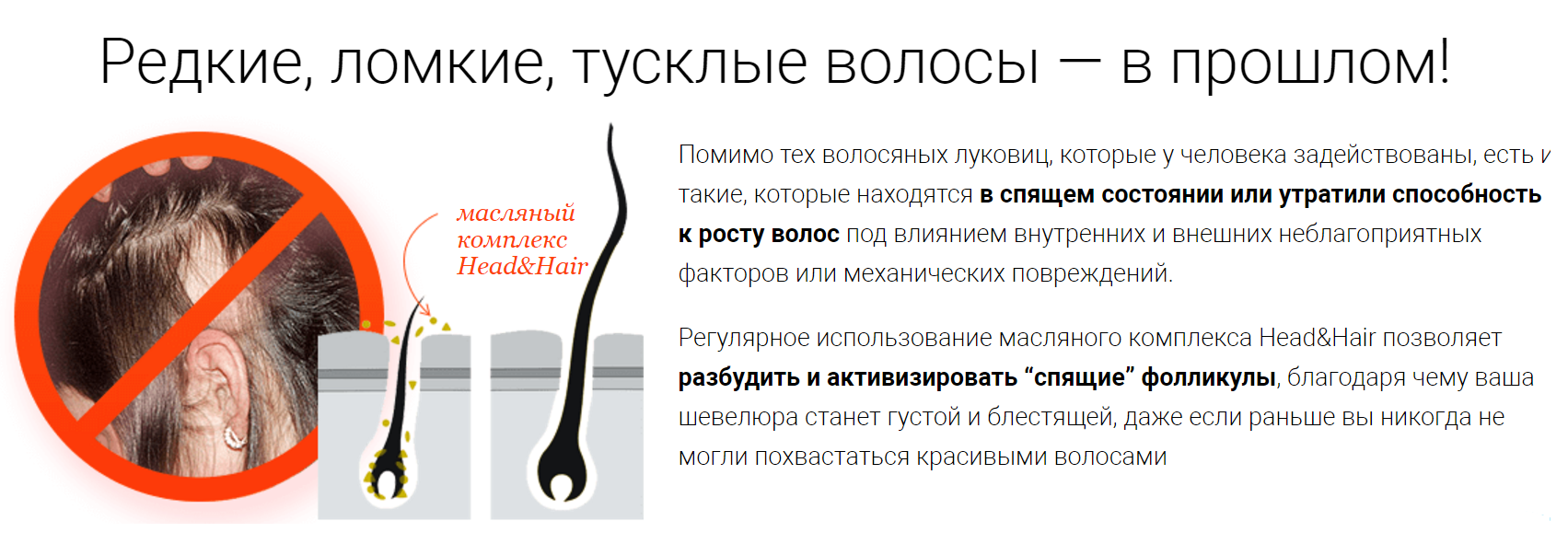 Истончение волос: причины (лечение) - клиника «доктор волос»