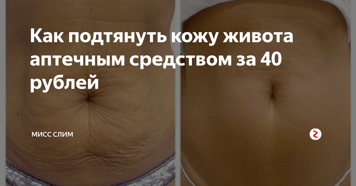 Как подтянуть кожу на животе после похудения: салонные и домашние методики