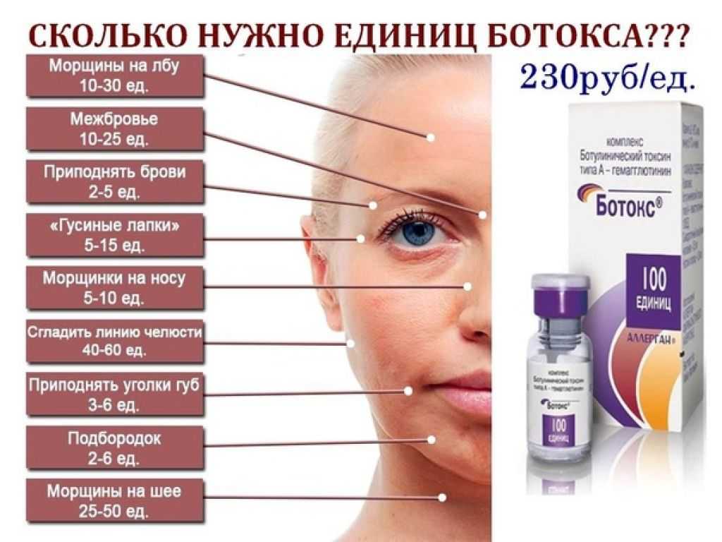 10 важных фактов об инъекциях ботулотоксина (ботоксе) для пациентов