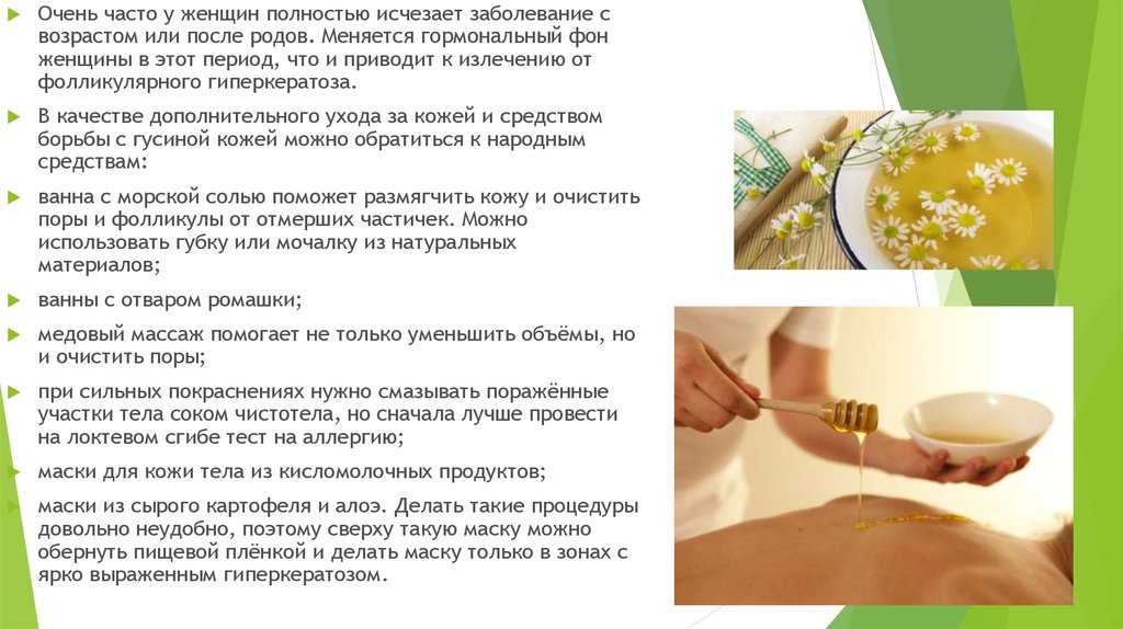 Гиперкератоз