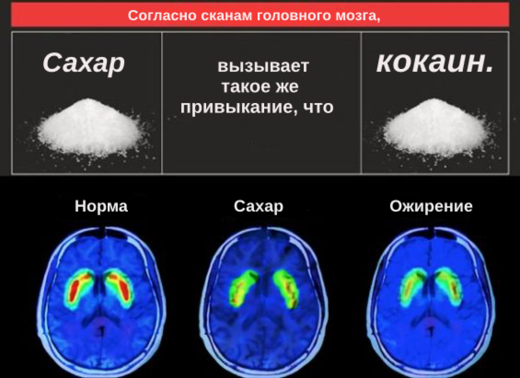 Баланс сахара в крови для щитовидной железы | тиреоидит хашимото