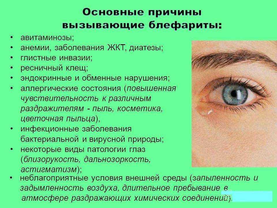 Желтые глаза: причины и лечение, симптоматика