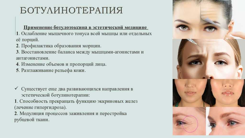 Морщины - причины и механизмы возникновения. методы профилактики, лечения и разглаживания морщин. роль ботокса в лечении морщин