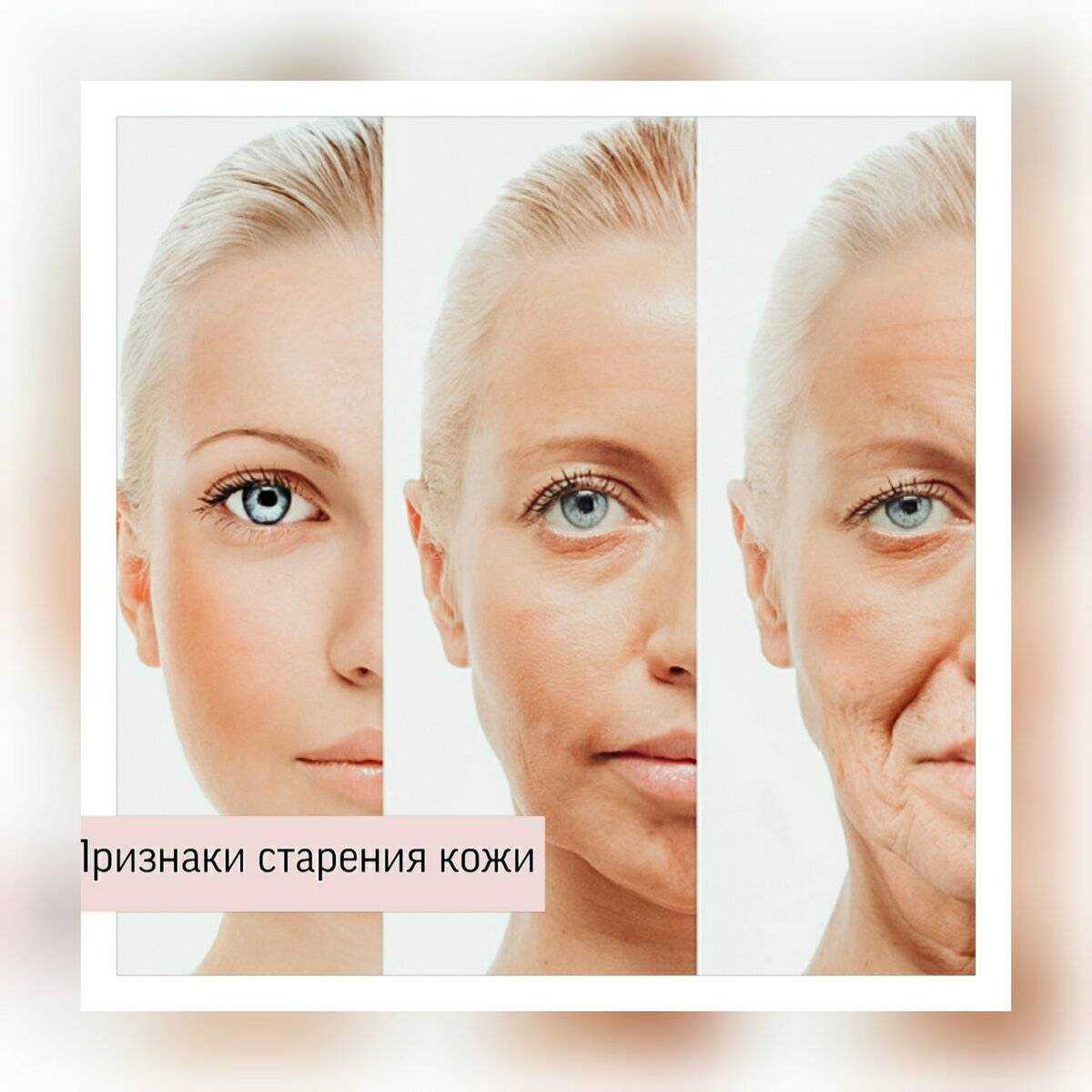 Косметологические процедуры после 50 лет. какой метод подтяжки выбрать | школа красоты