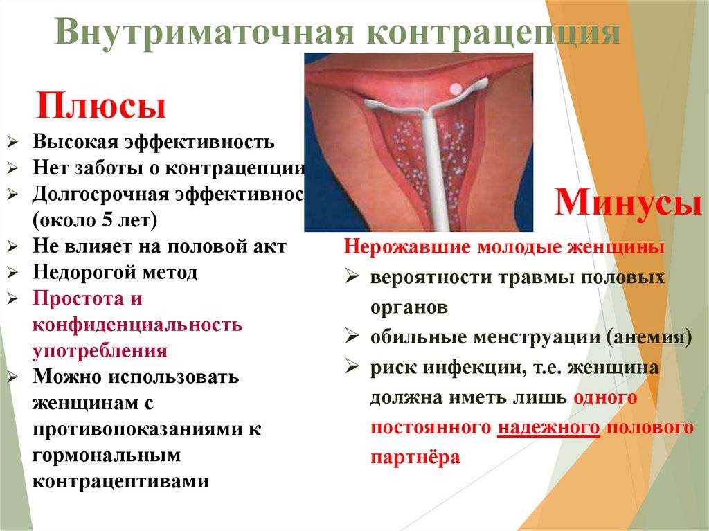 Выпуск 449. мифы про аяуаску | интеллектикс - все о развитии интеллекта
