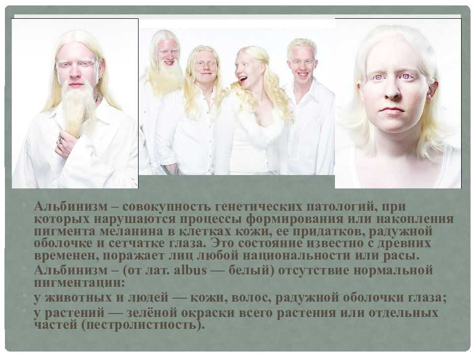 Альбинизм. причины, симптомы и лечение