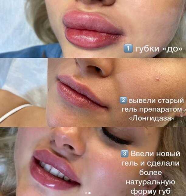 Возрастной татуаж